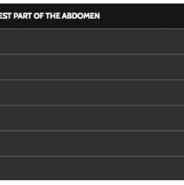 Custom Fitted OTC Comfort Back Brace w/ Rigid Spinal Stays (2456)